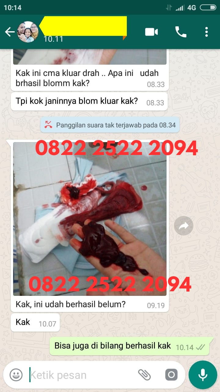 Daftar Merek Obat Penggugur Kandungan yang Dijual di Apotek Farmasi Terbaru