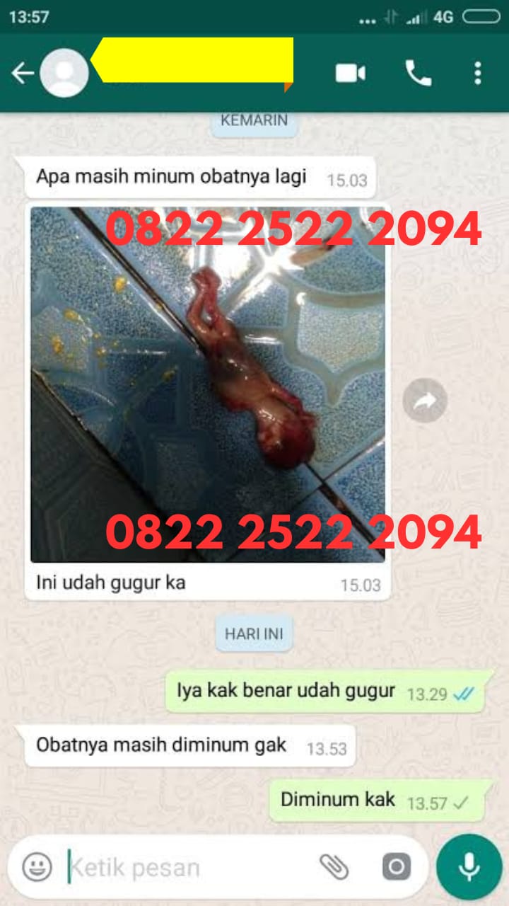 Daftar Merek Obat Penggugur Kandungan yang Dijual di Apotek Farmasi Terbaru