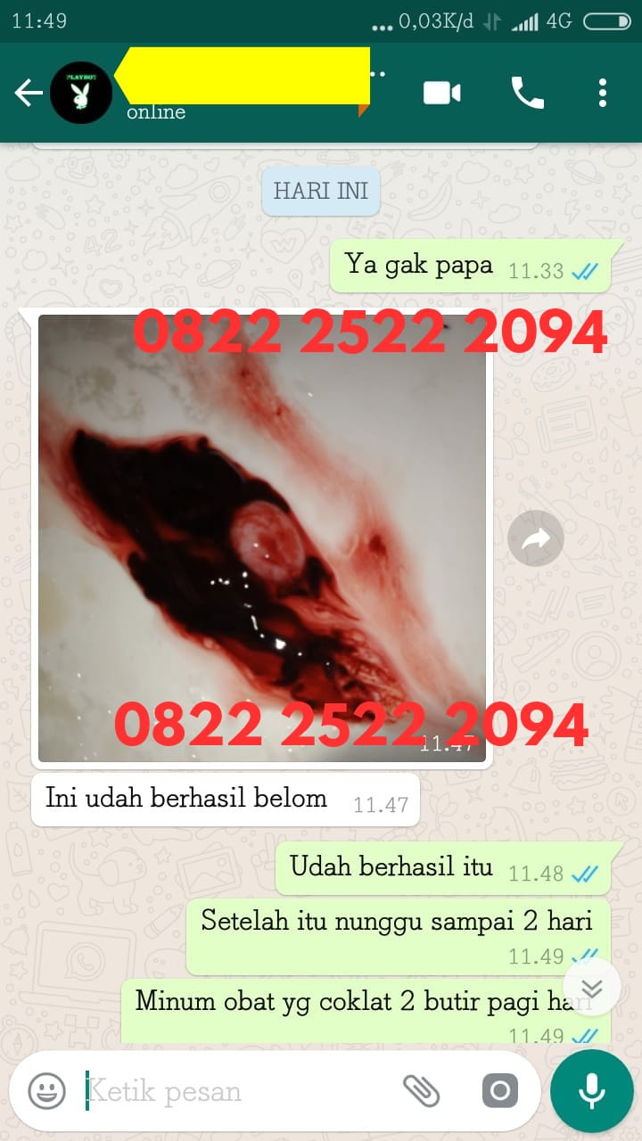 Daftar Merek Obat Penggugur Kandungan yang Dijual di Apotek Farmasi Terbaru